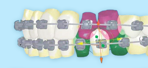 佳德口腔数字化矫正